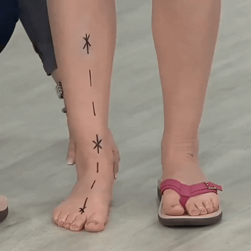 Footnity™ OrthoStep Summer Sandals